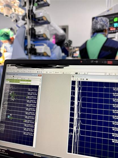 An operating room scene with surgical staff in the background, focused on a computer display showing neurophysiological data and graphs.