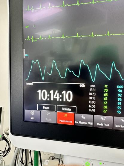 A medical monitor displaying vital signs, including heart rate and oxygen saturation levels. The screen shows time elapsed (10:14:10), ECG waveforms, and control buttons labeled in Spanish.