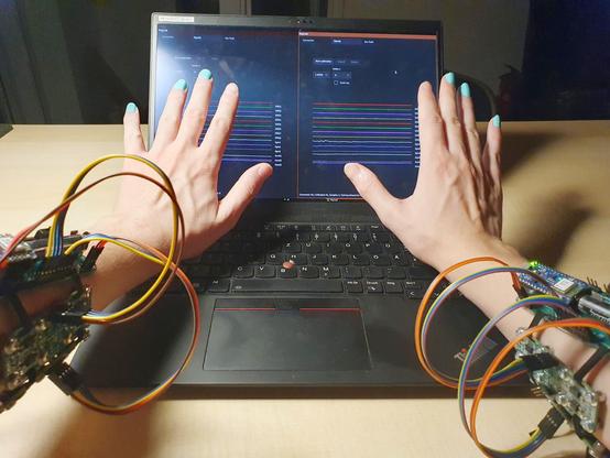 A person wearing 2 PsyLink electrode armbands at the same time, one on each arm. Spreading out the fingers. In the background, there's a laptop with the PsyLink user interface running, 2 windows side by side, one for each PsyLink, showing various graphs.