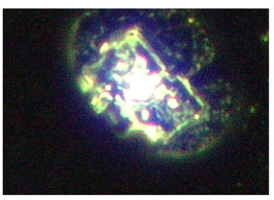nano IT in Articaine Epinephrine