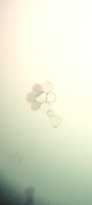An image taken with a phone through microscope eyepiece. The pollen is gathered to look like a daisy flower.