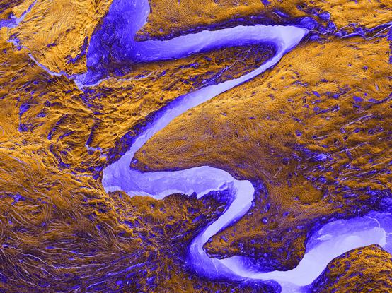 This is a scanning electron microscopy image of the cranial sutures in the rat skull. 🔬💀🐀 These are fibrous joints where the bones of the skull interdigitate, allowing for flexibility and growth during infancy and early childhood before fusing in adulthood.