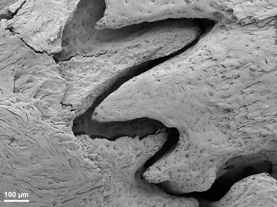 This is a scanning electron microscopy image of the cranial sutures in the rat skull. 🔬💀🐀 These are fibrous joints where the bones of the skull interdigitate, allowing for flexibility and growth during infancy and early childhood before fusing in adulthood.