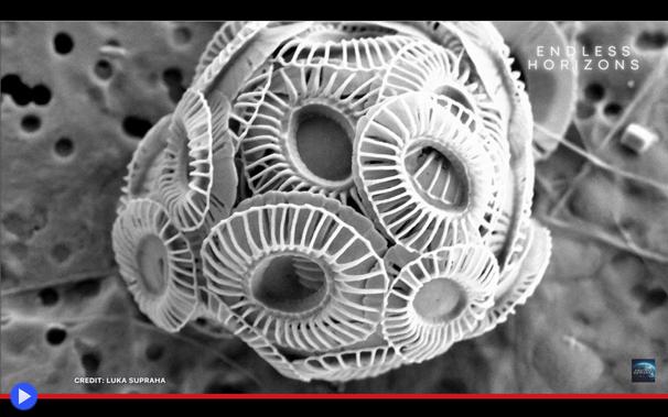 Immagine ingrandita molte volte di un microrganismo in bianco e nero, che si presenta come una serie di anelli sovrapposti disposti nella forma di una sfera.