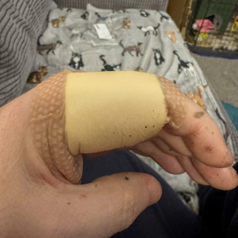 My poor infected finger :-(