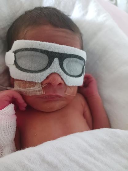 Un bébé prématuré porte une protection en mousse pour les yeux avec un dessin de lunettes de soleil