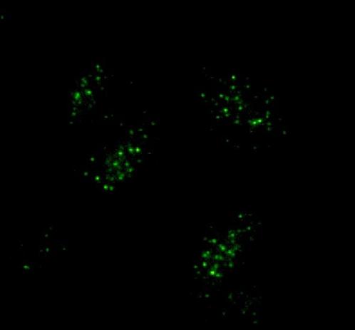 Fluorescent images of cells with green dots where telomeres are located. The background is black.