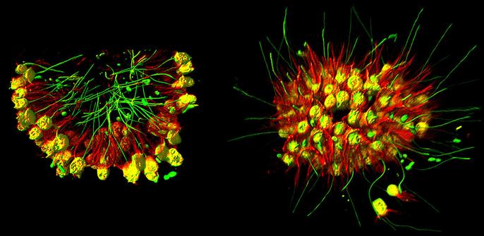 3D reconstruction of a colony of microscopic single celled flagellated creatures in 2 different shapes