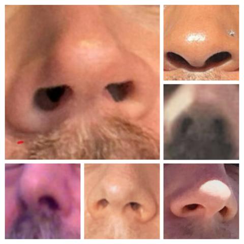 Viele Nasen von Selfies die aussehen wie Steckdosen #plugface