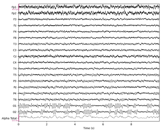 Artifical brain waves with channels using a 10-20 system. The occipital channels have looots of alpha.