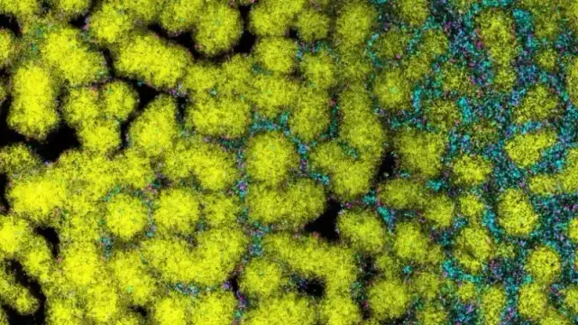 Fluorescence microscopy picture of a surface full of bacterial colonies