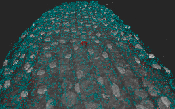 With M. Grison, golgi (cyan) and pan-staining (gray)