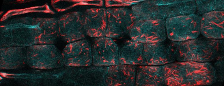 With M. Grison, ER (cyan) and actin (red) staining