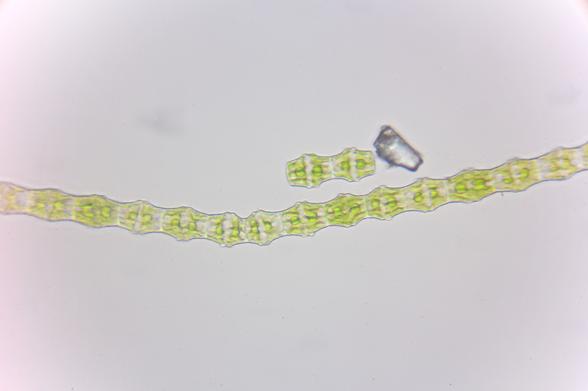 photo of the same specimen at approximately 422x optical magnification

the somewhat irregular hexagon-ish shapes of the cells are more clearly visible, as well as the distinct green dots inside. Next to the long filament is a small fragment consisting of two cells