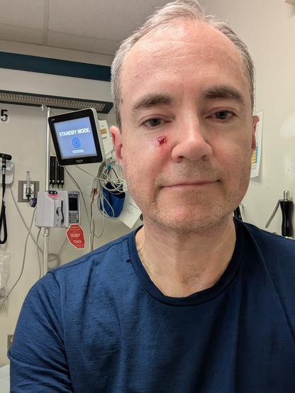 Got smacked by a freewheeling hand winch crank. Oops. The nice thing about going to a backwoods hospital in the middle of nowhere is that there was only one person in the emergency waiting room, and they didn't look very sick. Only a half-hour wait. And the guy next to us was sent home and told to take Tylenol for his sore muscle.