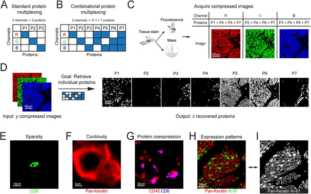 Figure 1: Combinatorial channel multiplexing escalates protein imaging

(A) In standard protein imaging, the image of each protein (columns) is acquired on a separate measurement channel (e.g. fluorescent color, rows). (B) In combinatorial protein multiplexing, the image of each protein (columns) is acquired on a unique combination of measurement channels (rows). This increases the number of proteins measured using a given number of channels exponentially. (C) Illustration of the acquisition of combinatorically-compressed images using fluorescent or mass-based approaches. Each channel in the image depicts the signal of multiple proteins. (D) Given compressed images acquired as detailed in (B-C) and the combinatorial staining matrix, the objective is to reconstruct the underlying single-protein measurements. (E-I) Examples of properties of protein-images that can serve as constraints during signal reconstruction. (E) CD8 exhibits sparse staining in tissues. (F) Keratins exhibit continuous signal. (G) CD8 (blue) is co-expressed with CD45 (red). (H) Pan-Keratin (red) exhibits membranous staining while Ki-67 exhibits nuclear staining (green). (I) Same as in (H). Although both proteins are shown in grayscale, they can be differentiated by their unique staining patterns.