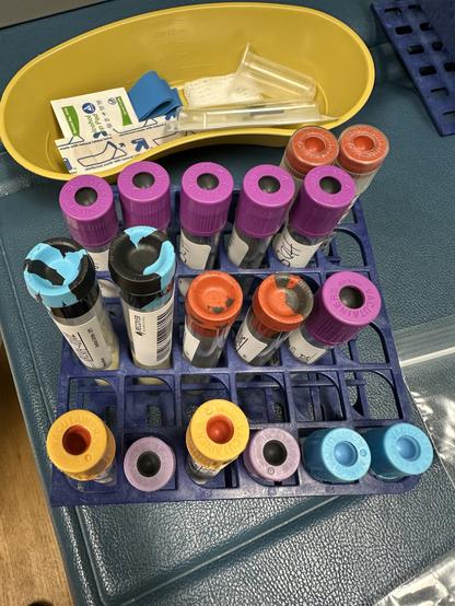 A collection of blood collection tubes in various colors, organized in a rack.