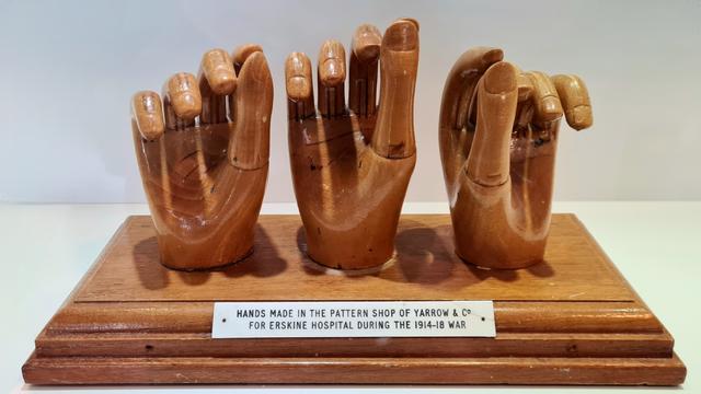 Examples of three artificial hands made for injured First World War soldiers and sailers by a Clyde shipyard.