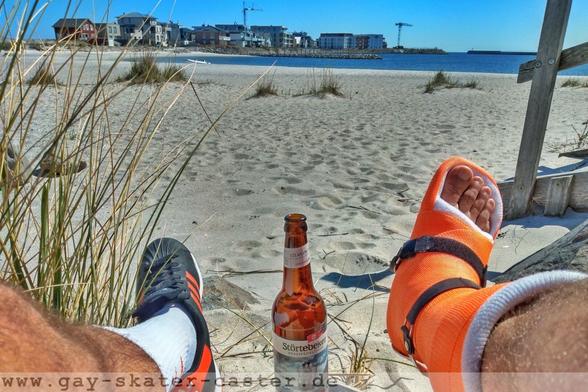 two lower legs with a beach in the background. one leg in an Adidas sneaker, the other one in a cast.
