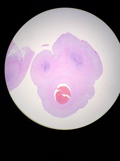 Photomicrograph of a cross section of umbilical cord that resembles the character Mr. Bill
