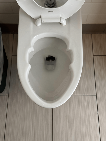 A top down view of a toilet in the bathroom in a hospital. It is clean and larger than the usual toilet. The shape of the toilet’s opening is sort of similar to human head.