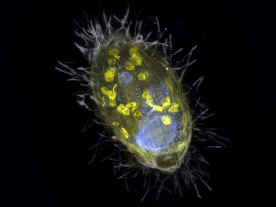 fluorescence microscopy picture of a complex microbial cell