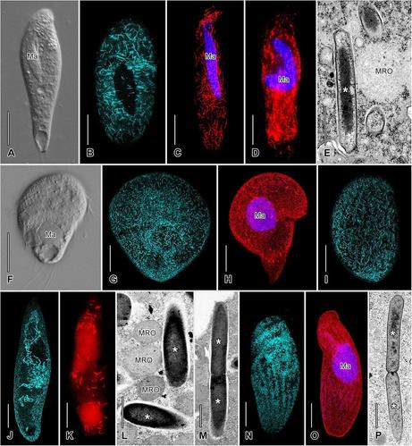 electron and fluorescence microscopy pictures of complex microbial cells