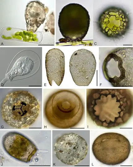 photos of various vase-shaped microbes