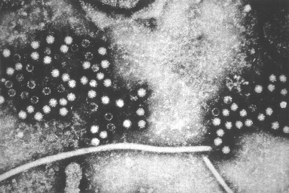 Elektronenmikroskopische Aufnahme zahlreicher kugelförmiger Hepatitis-E-Viren (HEV): Graustufiges Bild mit hellen, kleinen Kugeln auf dunkelgrauem Grund. Daneben zwei fadenförmige Strukturen. © CDC