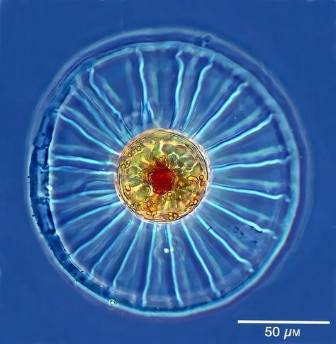 microscopic photo of a spherical single-celled alga