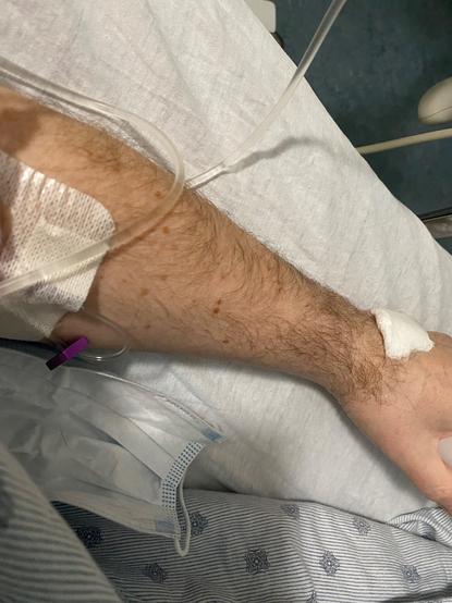 The hairy arm of an old white guy with freckles hooked up to an IV on a hospital bed.