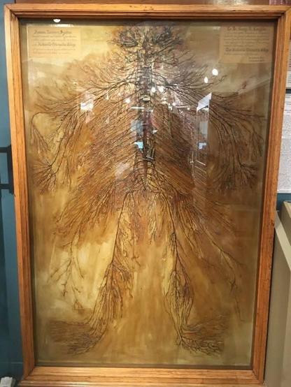 This is a real, intact human nervous system.