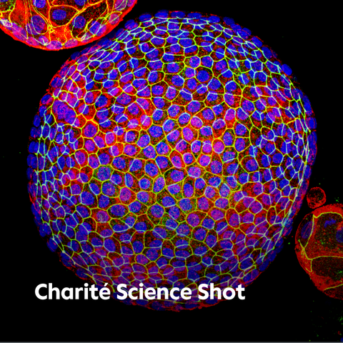 Bildfüllende Kugel aus Zellen, deren Ränder gut erkennbar gelb angefärbt sind. Der Zellinhalt erscheint blau, an manchen Stellen mit pinken Einsprenkelungen. Schrift: Charité Science Shot © Charité | Jan Schmoranzer