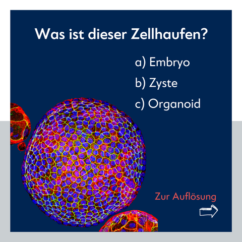 Texttafel, auf der die Kugel noch einmal klein dargestellt ist. Der Text: "Was ist dieser Zellhaufen? a) Embryo, b) Zyste, c) Organoid. Zur Auflösung" [Pfeil nach rechts] © Charité | Jan Schmoranzer