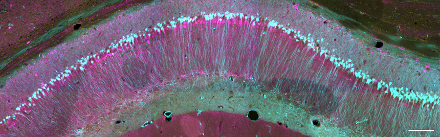 Image of different subsets of CA1 pyramial cells, with calbindin-positive cells in magenta and the other cell type in cyan (IHC for calbindin, AAV-driven fluorophore expression for the other).
