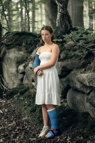 Mädchen mit Gipsbein und Gipsarm steht vor einer Steinmauer in einem Wald und schaut in die Kamera