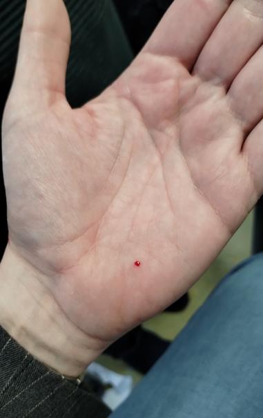 een hand net een rood druppeltje bloed erop