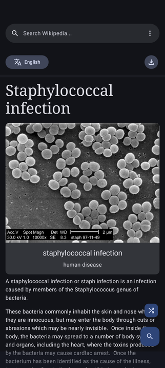A screenshot from the WikiReader app showing an article from the Wikipedia website.