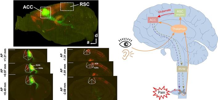 The ACC receives a substantial number of projections from the RSC. Top left: Sagittal view of 3D-reconstructed whole-brain labeling in VISoR imaging (red: DsRed+; green: EGFP+). White dashed boxes represent the regions of ACC and RSC in the brain. Scale bar: 1 mm. a: anterior; d: dorsal. Bottom left: Representative coronal sections of VISoR imaging in the ACC (left panel) and RSC (right panel). Scale bar: 1 mm. Right: A simplified model for supraspinal facilitation of nociception by RSC-ACC excitatory pathway. The peripheral visual, auditory sensory, and somatosensory inputs (the orange lines) are conveyed to the thalamus. Then, the thalamus relays these sensory inputs to the cerebral cortex, such as the ACC and RSC. The ACC, as a high brain center for pain processing, is innervated by not only the subcortical thalamus but also the supracortical RSC (the red arrow lines) to integrate the nociceptive information. The excitatory RSC-ACC pathway probably involves in the combination of pain processing and memory (such as the pain-related contextual memory) by an engram mechanism in the RSC.