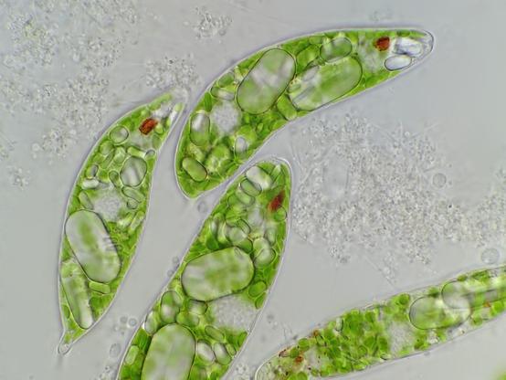 image/jpeg a microscopic photograph of several elongated very green cells with an obvious red dot on one end and oddly shaped clear inclusions within the cytoplasm.
Chris M posted in:
https://www.photomacrography.net/forum/viewtopic.php?t=16566