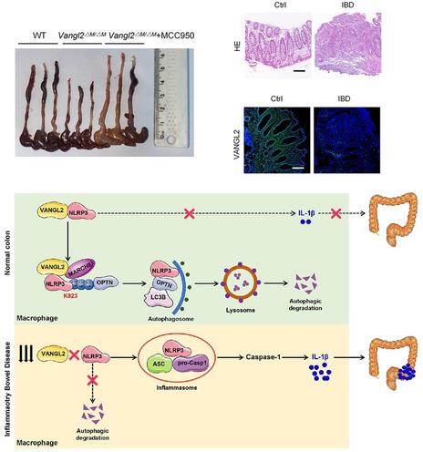 Top left: intestinal gross tissue was measured in the WT, Vangl2ΔM/ΔM, and MCC950 treated Vangl2ΔM/ΔM mice after DSS treatment (n = 7).  Top right: HE staining was used to compare the colonic morphology between health control and IBD patients (upper panel). The expression of VANGL2 in colon of healthy control and IBD patients was detected by immunofluorescence staining (lower panel). Bottom: Schematic diagram of the action of VANGL2 in IBD.