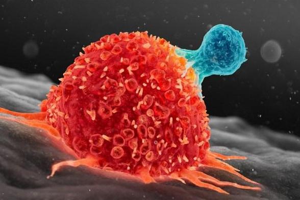 Lotta al cancro, scoperte cellule ibride che potrebbero invertire la malattia