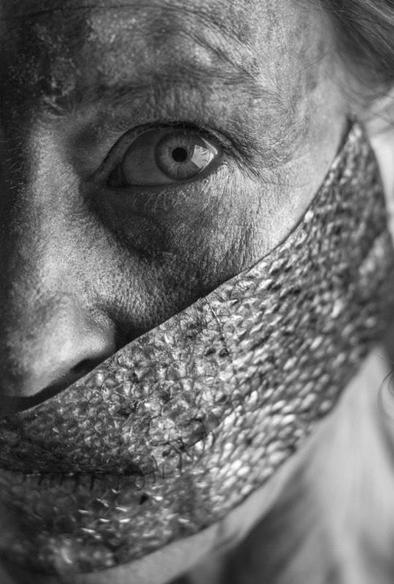 black and white photo, portrait format, a face cut in half lengthways, the mouth area covered with silvery, scaly, shiny fish skin, consisting of two pieces sewn together. It looks as if the fish skin is sewn onto the face to close the mouth. The visible eye looks intensely at the viewer and replaces the missing language with its expressiveness.