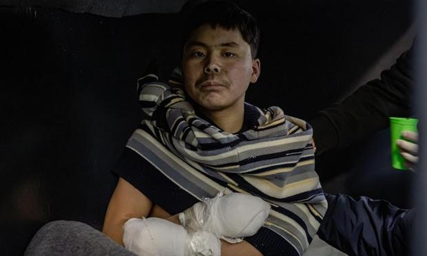 Un soldado norcoreano capturado por Ucrania, en una imagen autorizada por el Gobierno de Kiev. (Anadolu via Getty Images)