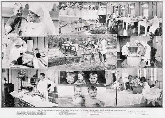 Black-and-white photo montage: How the Zealand’s Crippled Children Are Cared For at Rotorua: The Splendid Work of Healing Among the Infantile Paralysis Patients. 1926. Description: A montage of 10 photos showing medical staff and some of the 80 children at the King George V Hospital in Rotorua, where the thermal pools were used as part of the treatment regime. Citation: Supplement to the Auckland Weekly News, 22 July 1926, p. 47. Auckland Libraries Heritage Collections AWNS-19260722-47-01. https://kura.aucklandlibraries.govt.nz/digital/collection/photos/id/248941