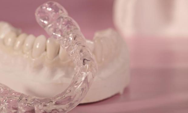 Imagen de archivo de una férula dental. (Getty Images)