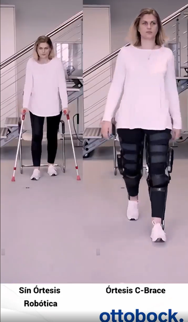 A woman is shown in two side-by-side images. 

On the left, she is using crutches and wearing a white long-sleeve shirt with black pants and white sneakers. 

On the right, she is walking without crutches, wearing the same outfit, but with a robotic orthosis on her legs. 

The text at the bottom reads "Sin Órtesis Robótica" (without prosthetic) on the left and "Órtesis C-Brace" (with prosthetic) on the right. 
The logo "ottobock" is visible at the bottom.