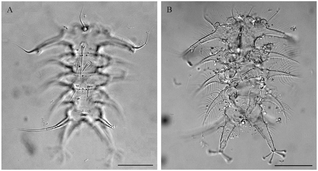 Microscopic images of Neostygarctus lovedeluxe holotype in dorsal view:

Panel A: Shows a less detailed dorsal view with visible cirri and leg appendages. The body segmentation and dorsal spines are faintly distinguishable.
Panel B: Displays a clearer dorsal view with prominent cirri, leg appendages ending in claw-like structures, and detailed dorsal spines. Fine structures such as secondary clavae and filamentous features are more visible.
Both panels include scale bars for size reference.