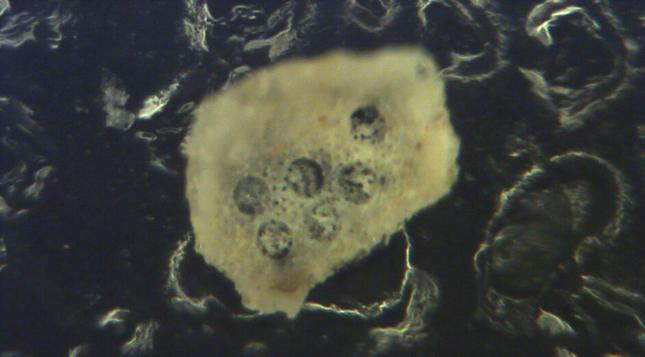 photo of an irregularly shaped microscopic organism