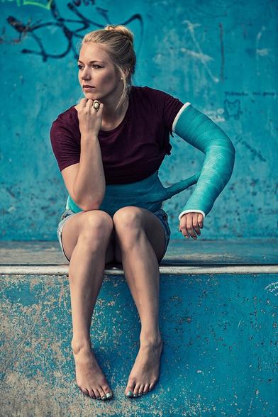 Young woman with arm- and body-cast sitting barefoot on a halfpipe. The halfpipe, cast and toenails are almost the same shade of blue.